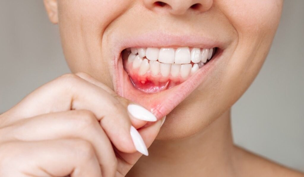Gum Disease Surgery in Adambakkam