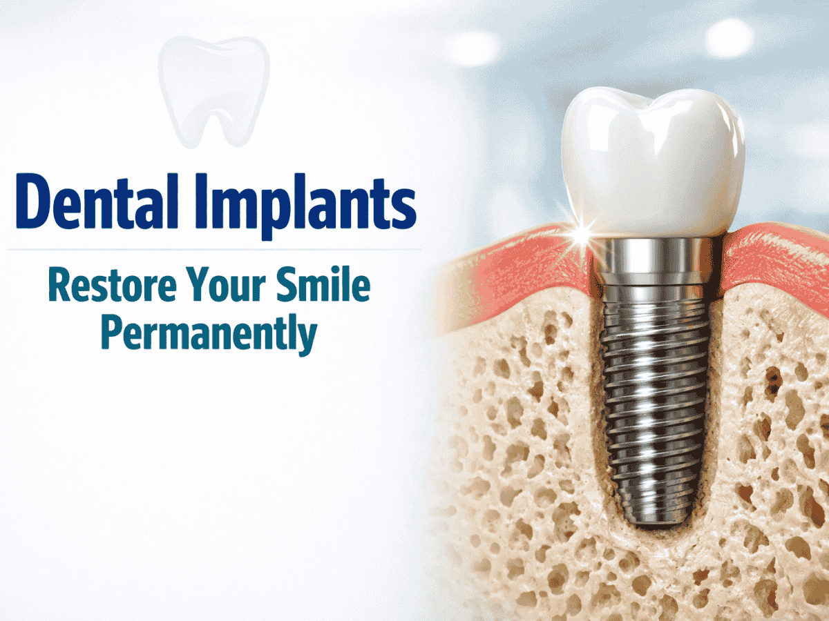 Dental Implants in Adambakkam