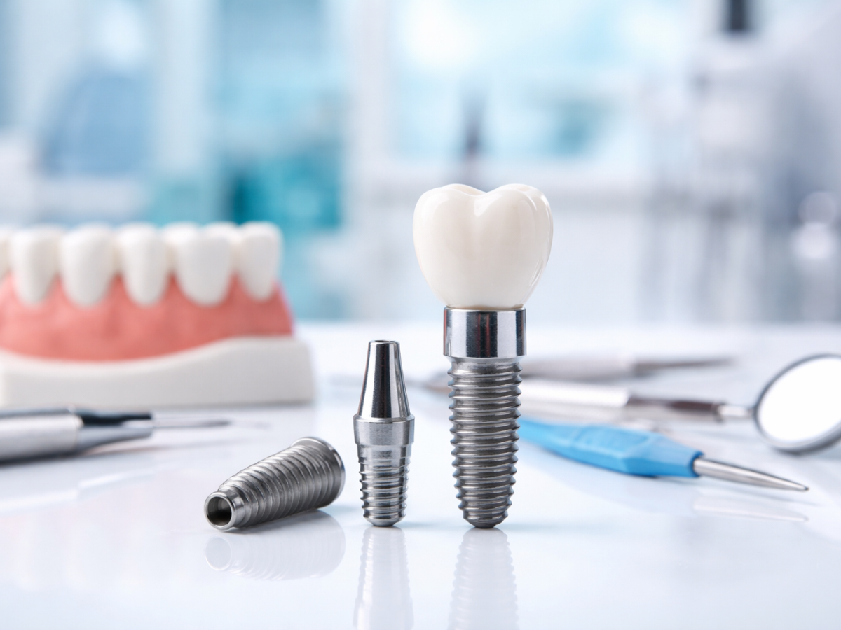 Dental Implants in Adambakkam
